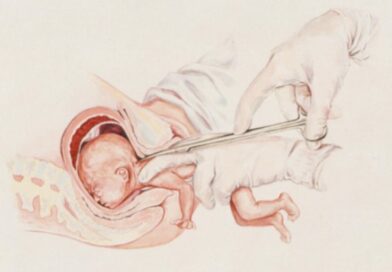 Avortement jusqu’à la naissance : la Grande-Bretagne reconnaît le droit à la mère de tuer son enfant à naître